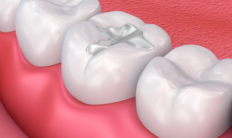 Loi Ich Cua Tram Rang Tham My